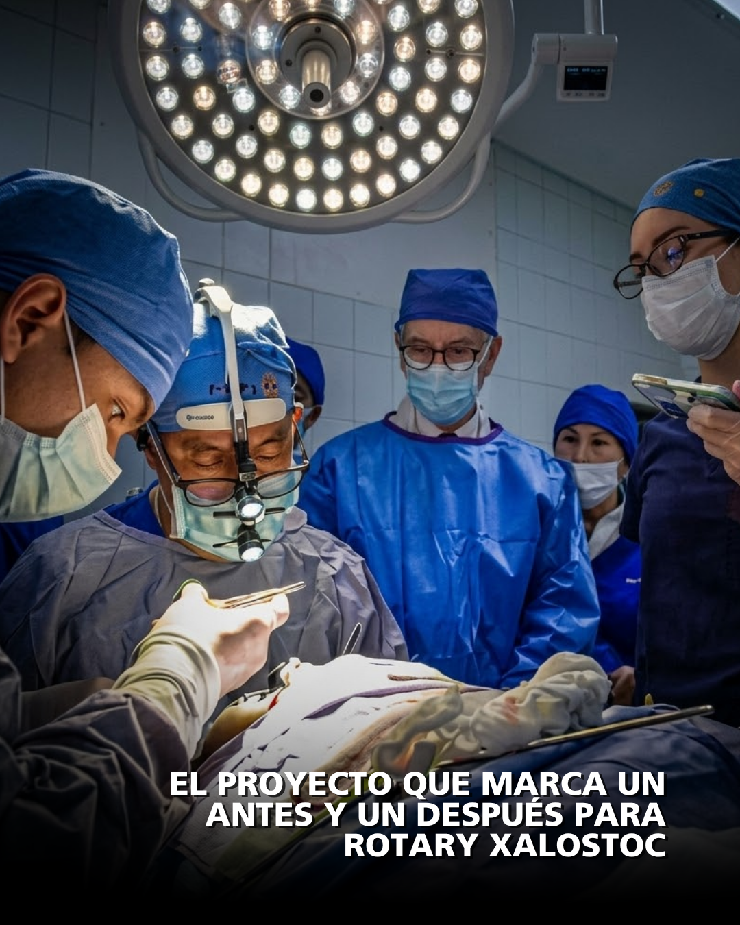 El proyecto que marca un antes y un después para Rotary Xalostoc